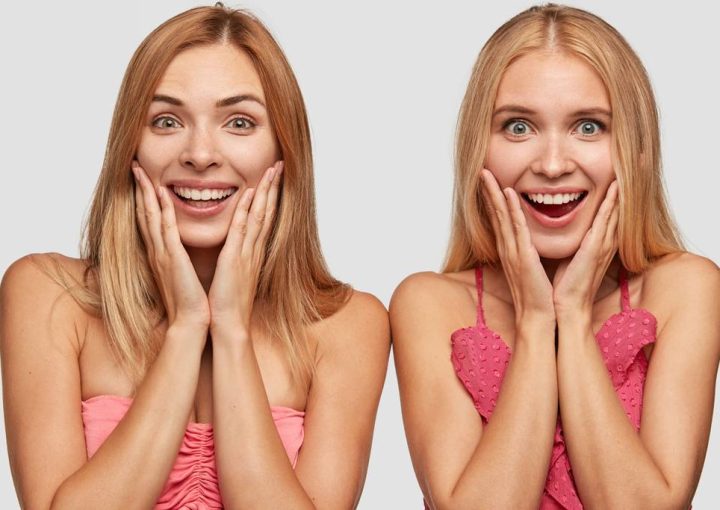 Gülüş Tasarımı Öncesi Sonrası Rehberi