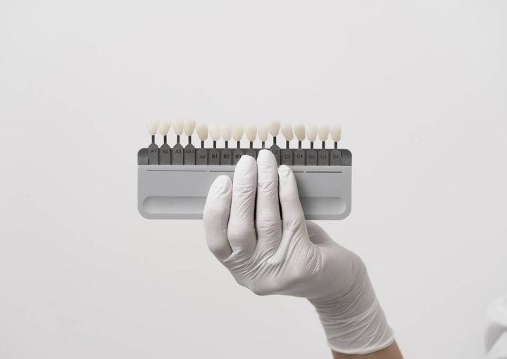 Zirkonyum mu Emax mı? Hangisi Daha İyi?